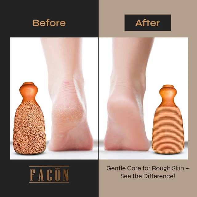 Alt view image 6 of 7 - Pumice Stone for Feet Callus Remover - Terra-Cotta Foot Scrubber with 2 Sides, 100% Pure Natural Foot Pumice Stone, Pedicure Pumice Stone Scrubber, Foot Exfoliator, Removes Calluses & Dead Skin
