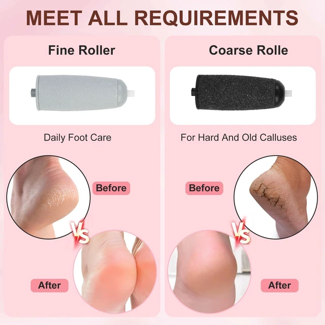 Alt view image 3 of 7 - Electric Callus Remover for Feet, Foot Callus Remover, Replaceable Head | 2-Speed adjustable,Portable,LED Llight&Washable Coarse/Fine Grinding Heads for Dead Skin Callus Removal and Foot Care
