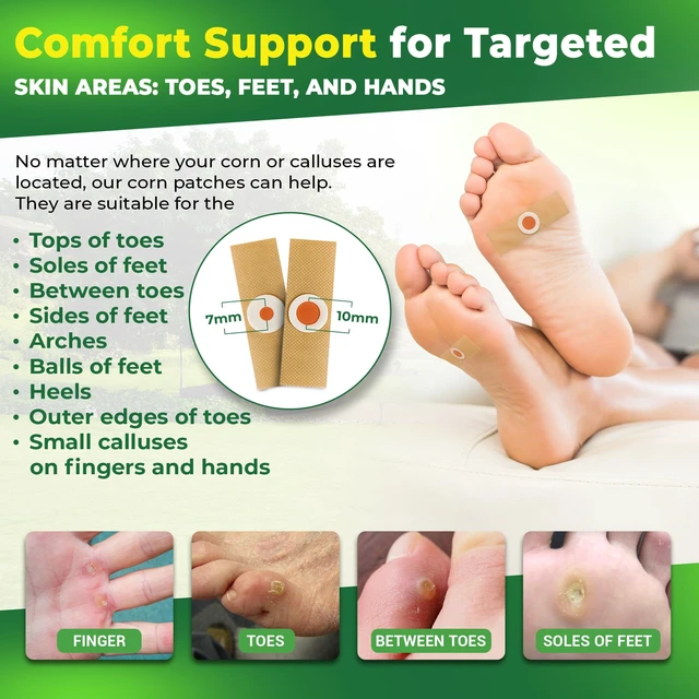 Alt view image 6 of 6 - Corn Remover Pads for Feet Toes: 30-Pack Extra Strength Salicylic Acid | For Small Callus Removal on Hands Too - Foot Corn Treatment Bandage with 15 Secure PU Films, 2 Core Sizes - Fast Pain Relief