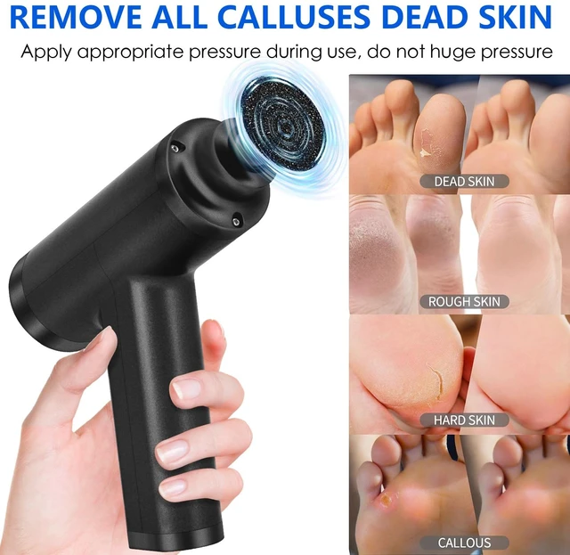 Alt view image 4 of 7 - Upgraded Electric Callus Remover 4500rpm Professional Foot Sander, Black | 10 Adjustable Speeds, 3 Interchangeable Grinding Heads, Remove Hard Dead Skin Stubborn Calluses