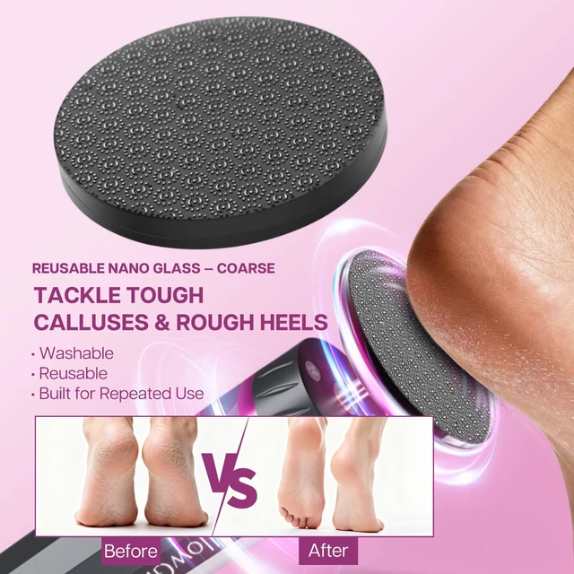 Alt view image 2 of 7 - Electric Foot Callus Remover with Reusable Nano Glass Heads | 9-Speed Cordless Foot File with 15,000 RPM Motor, Aluminum Body & Sandpaper Discs