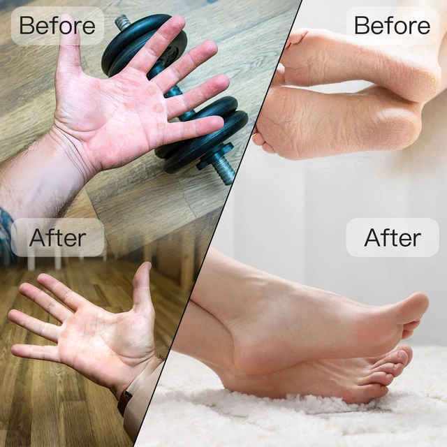 Alt view image 3 of 6 - Portable Electric Hand & Foot Callus Remover with 2 Glass Grinding Heads, Rechargeable 800RPM Mini Electric Hand & Foot File for Travel Outdoors Climbers Gym Athletes (E9 Black Gold)