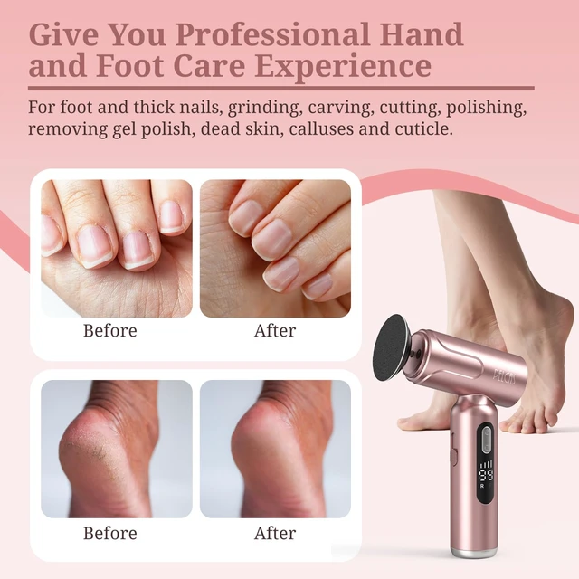 Alt view image 2 of 7 - Electric Foot Callus Remover, Pedicure Tool for Feet with LED Screen | 2 in 1 Manicure & Pedicure Kit for Foot Callus, Thick Nails, 100 PCS Sandpapers Electric Foot File for Women & Men, Pink