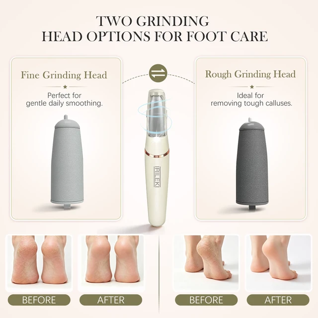 Alt view image 2 of 7 - Upgraded Electric Foot Callus Remover, Callus Removers for Feet, Pedicure Tools for Feet, Rechargeable Portable Foot File Pedicure Tools, Foot Care for Dead Skin, for Feet & Hands (Beige)