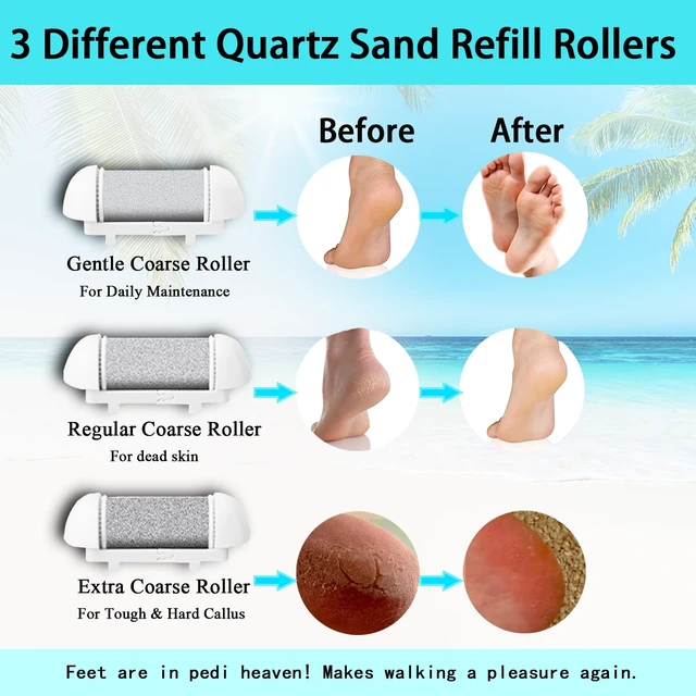 Alt view image 5 of 6 - Electric Callus Remover for Feet, Long Service Time Foot Scrubber, Rechargeable Electronic Foot Files, Professional Pedicure Tools Pedicure Kit Feet Care for Crack Heel, Women Gift (White)