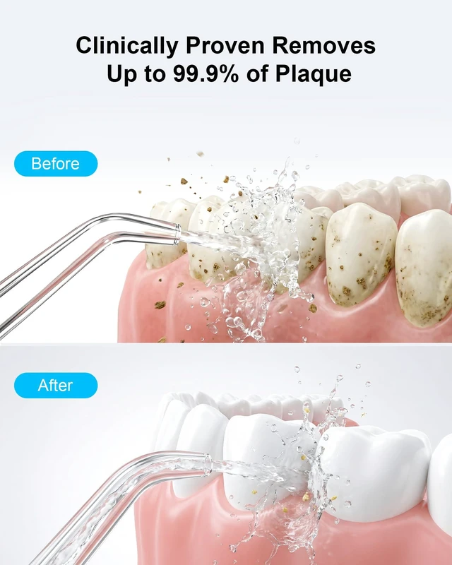 Alt view image 7 of 7 - Cordless Water Flosser - 6 Pressure Settings with 3 Modes, 220ml Compact Ergonomic Design, 30 Days Long Battery, IPX7 Waterproof Portable Oral Irrigator for Teeth, Gums & Braces (Black)