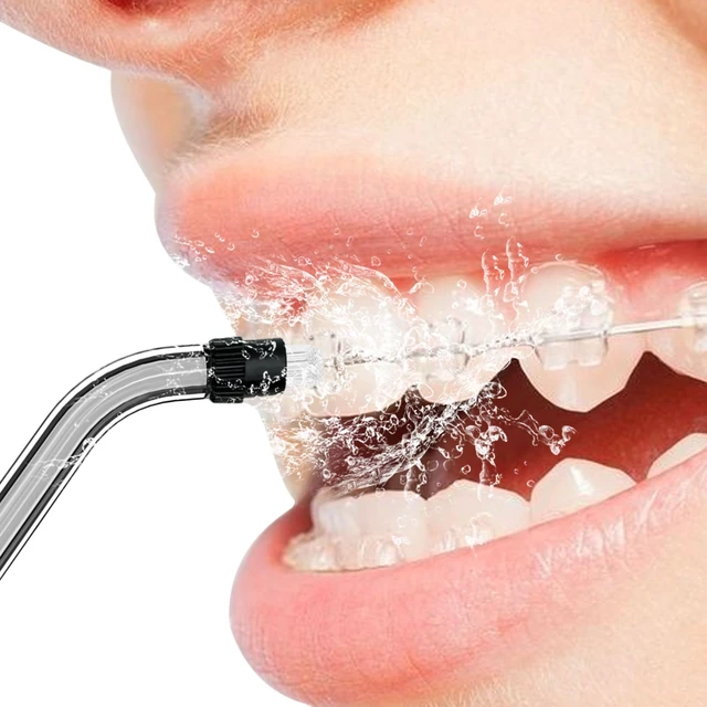 Alt view image 4 of 6 - Replacement Orthodontic Tip for COSLUS C20,E40,C31,C50,C51 Water Flosser | Oral Irrigator Jet Tip Only Compatible COSLUS F5020E, WFP14, F5023 Water Flosser(Black)