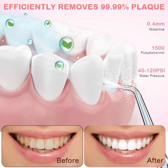 Alt view image 3 of 7 - Water Dental Flosser for Teeth Cleaning and Flossing with Travel Size Case Rechargeable Oral Irrigator, Portable Water Flosser for Adults, IPX7 Waterproof, 5 Jet Tips & 4 Modes, Pink
