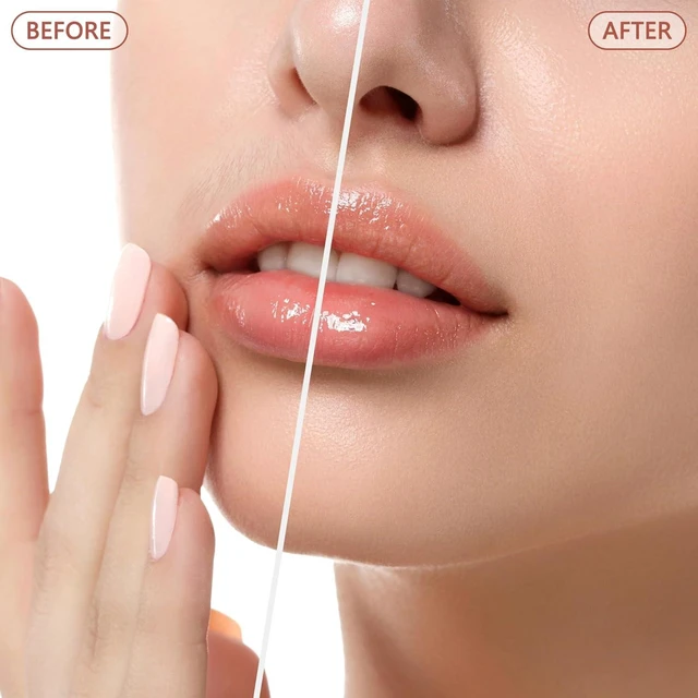 Alt view image 3 of 6 - Rechargeable Facial Hair Removal for Women - as Seen on TV Painless Face Shaver - Electric Hair Remover for Face Lips Peach Fuzz with Light (Rose Gold)