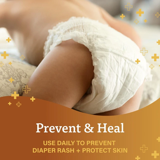 Alt view image 3 of 3 - A+D Original Diaper Rash Ointment, 1.5oz - Prevents & Protects with Vitamins A & D, Moisturizing Skin Protectant for Dry, Cracked Skin