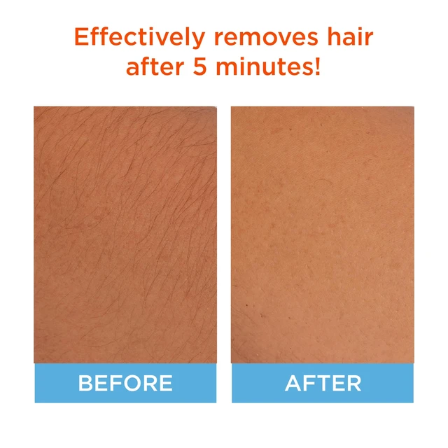 Alt view image 2 of 4 - Hair Remover for Face | Cream Depilatory + Aftercare Lotion | Sweet Almond & Shea Butter Infused