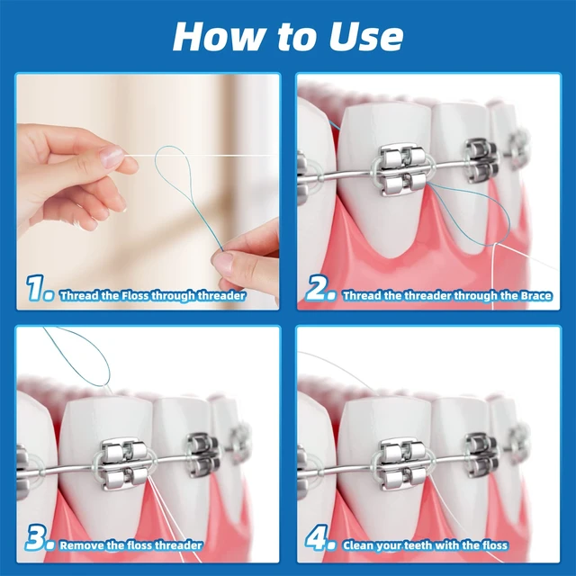 Alt view image 3 of 6 - Floss Threaders for Braces, Bridges, Implants, Deep Clean, 200 Count