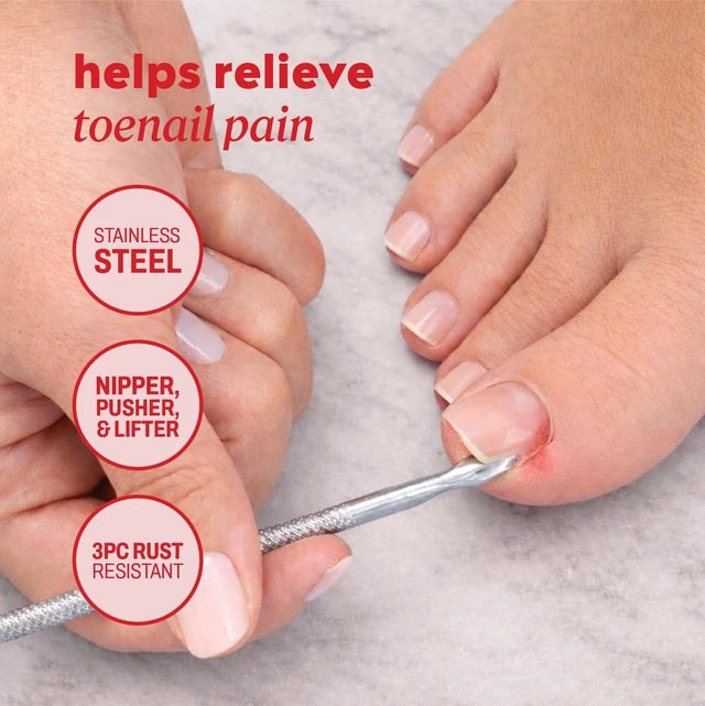 Alt view image 3 of 6 - Onyx Professional 3-Piece Stainless Steel Nail Care Kit with Ingrown Toenail Remover, Protective Case