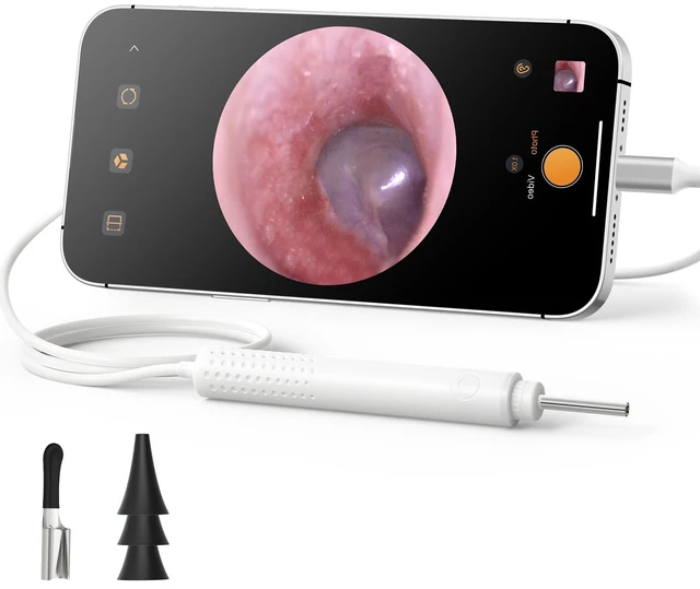 Main image of USB C Digital Otoscope with Light for iPhone 15/16/17 Android | 3.9mm Lens, 720P Ear Camera, Split-screen, 6 LED Lights, No WiFi Needed, Photo & Video, Plug & Play for Safe Home Ear Check