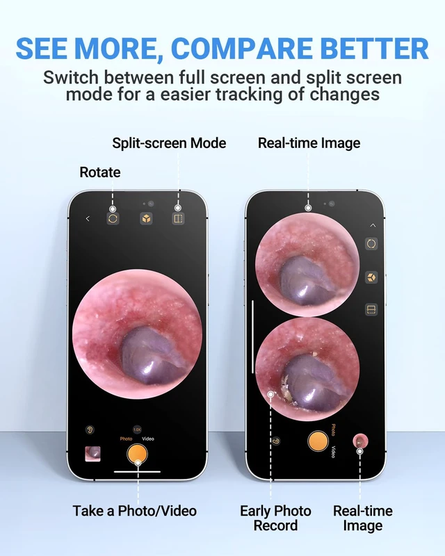 Alt view image 6 of 7 - USB C Digital Otoscope with Light for iPhone 15/16/17 Android | 3.9mm Lens, 720P Ear Camera, Split-screen, 6 LED Lights, No WiFi Needed, Photo & Video, Plug & Play for Safe Home Ear Check