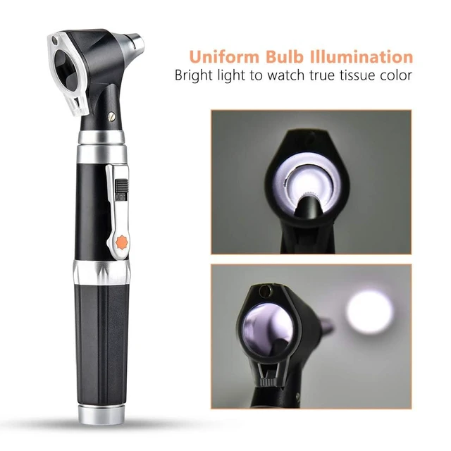 Alt view image 2 of 7 - 3X Otoscope with LED Handheld Ear Magnifier Scope for Doctor & Home | Portable Ear Check Scope with 8 Specula Caps & Storage Case for Adults, Kids, Pets, Dogs, Cats
