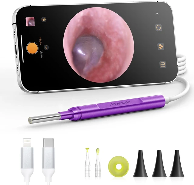 Main image of Digital Otoscope Compatible with iPhone & Android, Video Ear Scope Camera | Otoscope with Light, 3.9mm Lens, Plug & Play, Photo & Video, Split-screen, Earwax Removal Kit for Home Cleaning Checking