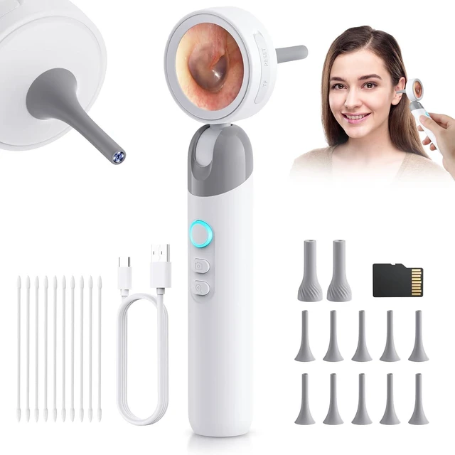 Main image of Digital Otoscope Ear Camera for Family, 1.38-Inch Screen, No App Needed | 32GB TF Card, Ear Camera with 4 LED Lights, 3X Magnification, Photo/Video, Telemedicine Ready, 90° Rotating Head