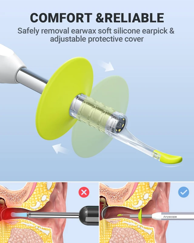 Alt view image 4 of 7 - Otoscope with Gyroscope, Ear Scope Camera, Compatible with iPhone/Android | Ear Camera with Gyroscope, Plug & Play, 3.9mm Otoscope With Light, Photo & Video, Split-screen mode,Earwax Removal Kit