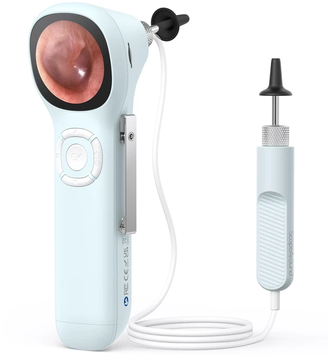 Main image of Otoscope with Light, No App Needed, HD Screen, Ear Scope Camera for Family | Ear Camera with Earwax Removal Kit for Home Cleaning Checking, Photo & Video, 3.9mm Lens, 8GB Card, LED Light, Type-C Port