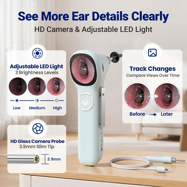 Alt view image 3 of 7 - Otoscope with Light, No App Needed, HD Screen, Ear Scope Camera for Family | Ear Camera with Earwax Removal Kit for Home Cleaning Checking, Photo & Video, 3.9mm Lens, 8GB Card, LED Light, Type-C Port