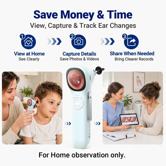 Alt view image 6 of 7 - Otoscope with Light, No App Needed, HD Screen, Ear Scope Camera for Family | Ear Camera with Earwax Removal Kit for Home Cleaning Checking, Photo & Video, 3.9mm Lens, 8GB Card, LED Light, Type-C Port