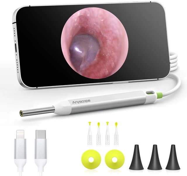 Main image of Digital Otoscope, Video Ear Scope Camera Compatible with iPhone/Android | 3.9mm Otoscope with Light, Plug & Play, Photo & Video, Split-screen mode, Earwax Removal Kit for Home Cleaning Checking