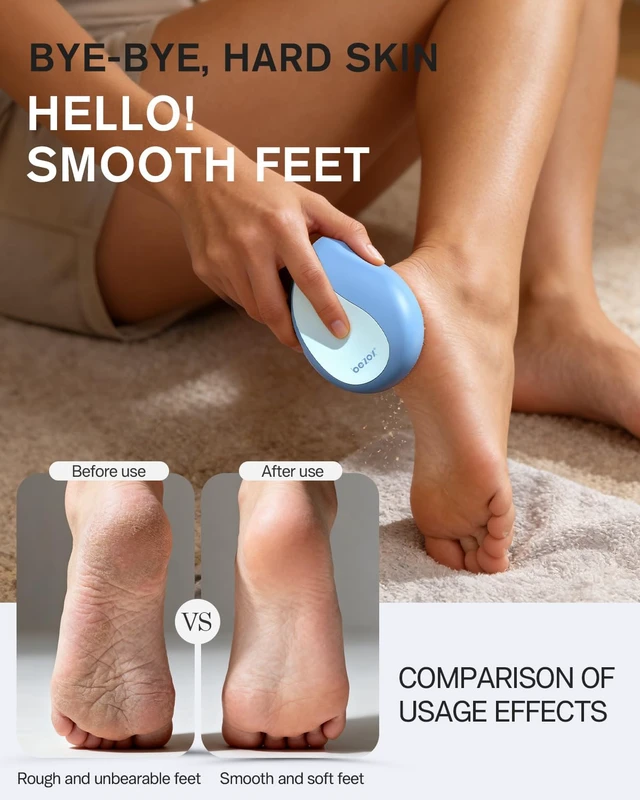 Alt view image 3 of 7 - Glass Foot File Callus Remover Professional Foot Scrubber for Dead Skin & Cracked Heels Premium Pedicure Tools for Feet with Anti-Slip Handle and Protective Cover - Blue