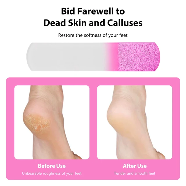 Alt view image 3 of 7 - 2Pcs (Pink + Blue) Glass Foot File Pedicure Rasp - Professional Pedicure Tools for Smooth, Soft Feet - Premium Foot Scrubber for Calluses, Corns, and Dead Skin Removal