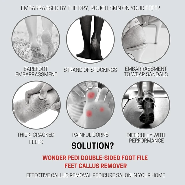 Alt view image 2 of 7 - Made in Germany Ceramic Stone and Stainless Steel Foot File, Double Sided Callus Remover, Feet Scrubber, Professional Pedicure Foot Care Tool Rasp, Long Lasting Foot Buffer, Heel Scraper, Wonder Pedi
