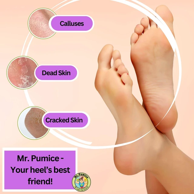Alt view image 2 of 6 - PUMI Bar Foot Callus Remover, Extra-Coarse, Purple, 4 Count | Pumice Stone for Feet, Extra-Coarse Foot Scrubber for Dead Skin & Calluses, Helps Smooth Feet & Heels, Use Wet or Dry