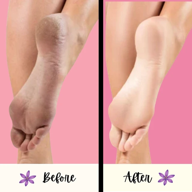 Alt view image 3 of 6 - PUMI Bar Foot Callus Remover, Extra-Coarse, Purple, 4 Count | Pumice Stone for Feet, Extra-Coarse Foot Scrubber for Dead Skin & Calluses, Helps Smooth Feet & Heels, Use Wet or Dry