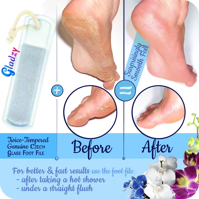 Alt view image 4 of 7 - Czech Glass Foot File - Two-Sided Different Grit Surface, Gentle Callus Remover, Pedicure & Spa Rough Skin Scrubber, Professional Toenail and Heels Care, EU Quality, Large Size