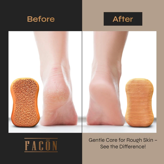 Alt view image 6 of 7 - Pumice Stone for Feet Callus Remover - Terra-Cotta Foot Scrubber with 2 Sides, 100% Pure Natural Foot Pumice Stone, Pedicure Pumice Stone Scrubber, Foot Exfoliator, Removes Calluses & Dead Skin