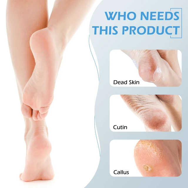 Alt view image 4 of 7 - 3 Pcs 4-in-1 Foot Scrubber Brush for Feet & Shower | Includes pumice stone, foot rasp, and sandpaper for dead skin removal and foot care.