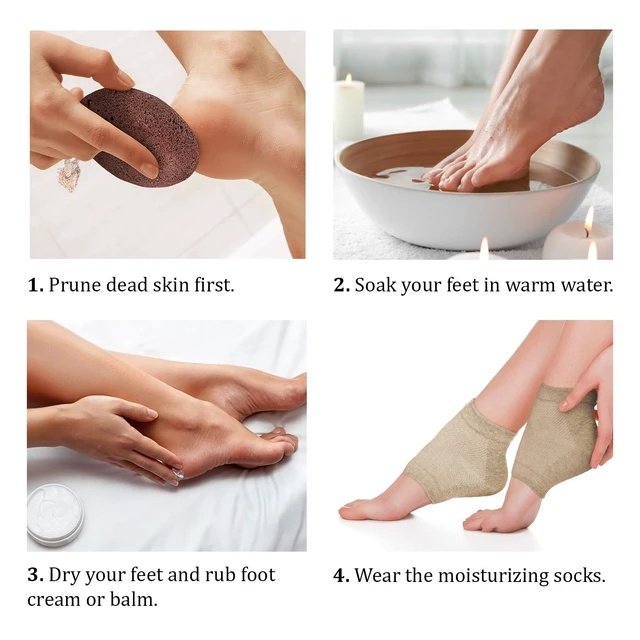 Alt view image 5 of 7 - Stone for Feet Set - Natural Lava Foot Stone Callus Removing Set - Foot Care Kit for Dry Cracked Feet Body Hands - Health Foot Care