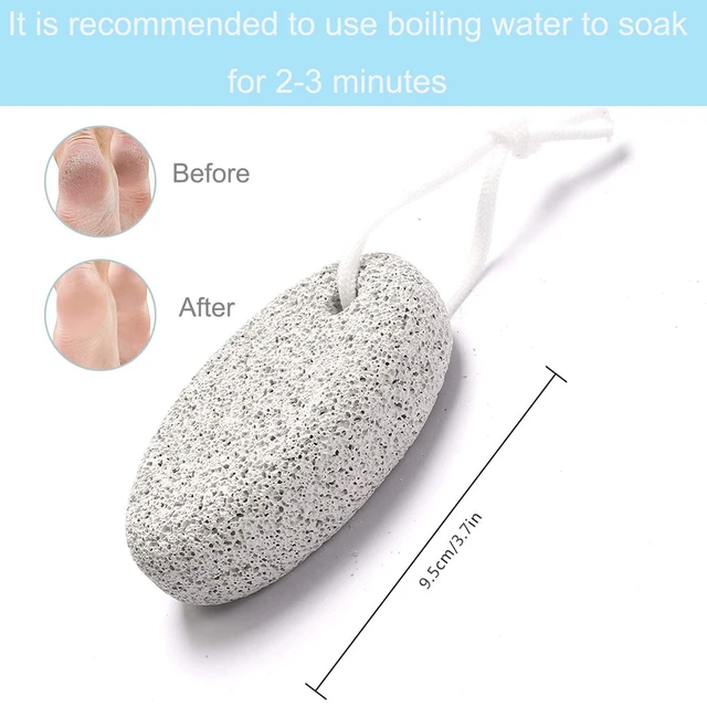 Alt view image 6 of 7 - Natural Pumice Stone for Feet, 3-Pack Lava Pedicure Tools Hard Skin Callus Remover for Feet and Hands - Natural Foot File Exfoliation to Remove Dead Skin, Heels, Elbows, Hands