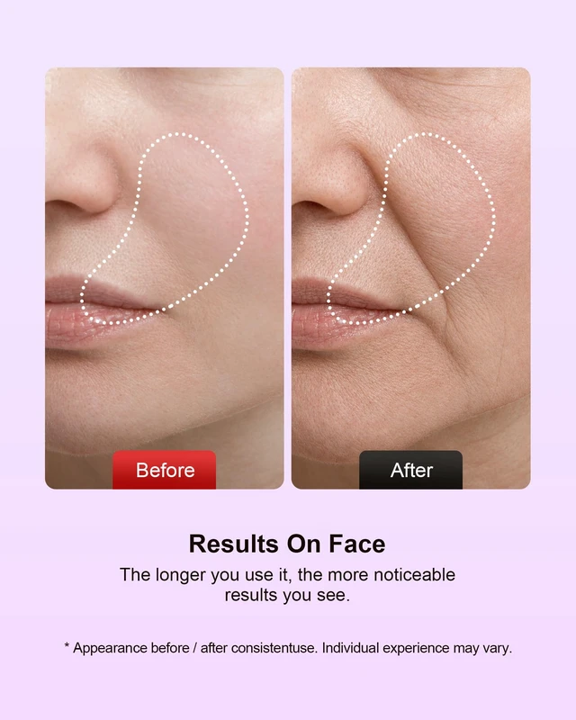 Alt view image 6 of 7 - Facial Massager, 7 Colors Red Light Therapy for Face and Neck | Face Lift Device with 113°F Heating Vibration , 3 Modes & 4 Adjustable Intensities for Multi Skin Care, Face culpting Wand