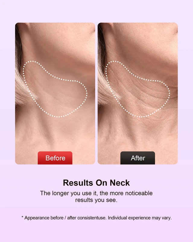 Alt view image 7 of 7 - Facial Massager, 7 Colors Red Light Therapy for Face and Neck | Face Lift Device with 113°F Heating Vibration , 3 Modes & 4 Adjustable Intensities for Multi Skin Care, Face culpting Wand