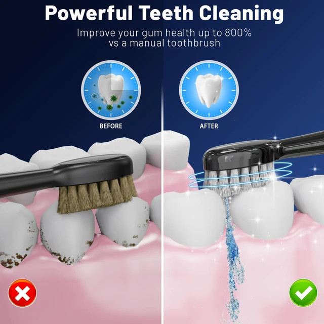 Alt view image 2 of 6 - Electric Toothbrush with Water Flosser,Portable Power Flossing Toothbrush | IPX7 Waterproof,Equipped Brush Head and Nozzle,for Travel and Home