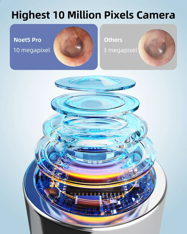 Alt view image 4 of 6 - Bebrid pro Ear Canal Wax Removal Tool Camera Tweezers - Note5 Pro Wireless Cleaner Otoscope with Light - Visual Ear Picker Scope with Videos - WiFi Cleaning Kit via Bebird App for Adults & Kids