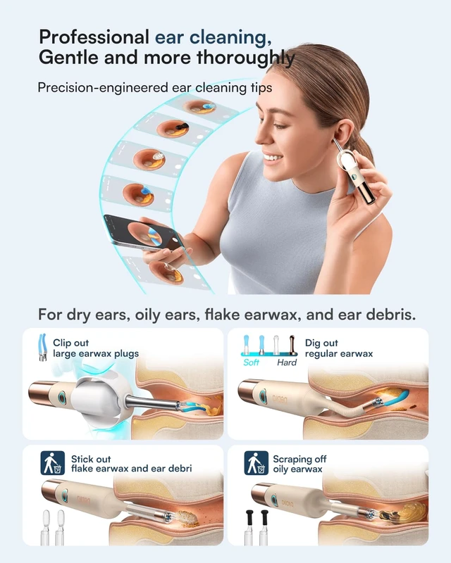 Alt view image 5 of 7 - Bebird Ultra 2K Ear Wax Removal Tool Camera, Visual Tweezers & Dropper Kit | HD Anti-fog Otoscope with 5G Wi-Fi, IP67 Flexible 3.6mm lens, 54 EarWax Tips for Wet, Dry or Stubborn Wax, FSA/HSA Eligible