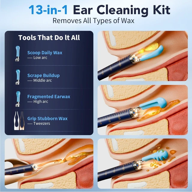 Alt view image 2 of 7 - Ear Wax Removal, Ear Cleaner with Camera 1296P HD,Visual Ear Cleaner with 6 LED Lights and Flexible Tip,Safe Ear Wax Removal Kit with Camera,Ear Cleaning Tool Gifts for Home Use