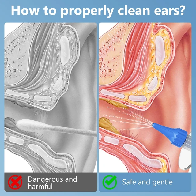 Alt view image 6 of 7 - Ear Irrigation Flushing Cleanr and 1920P Ear Cleaner with Camera | LED Light, 10 Replaceable Tips, 8 Silicone Ear Pick, for Home Use