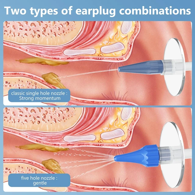 Alt view image 7 of 7 - Ear Irrigation Flushing Cleanr and 1920P Ear Cleaner with Camera | LED Light, 10 Replaceable Tips, 8 Silicone Ear Pick, for Home Use