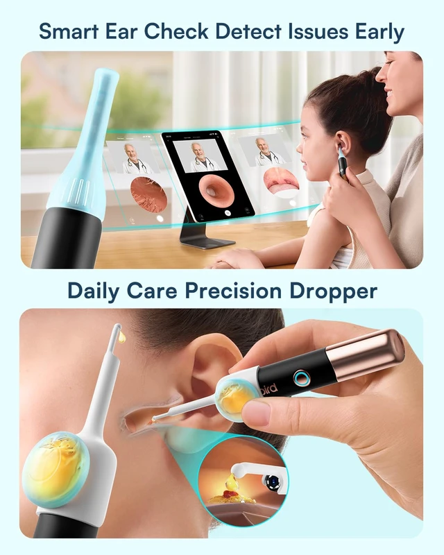 Alt view image 7 of 7 - Bebird Ultra 2K Ear Wax Removal Tool Camera, Visual Tweezers & Dropper Kit | HD Anti-fog Otoscope with 5G Wi-Fi, IP67 Flexible 3.6mm lens, 54 EarWax Tips for Wet, Dry or Stubborn Wax, FSA/HSA Eligible