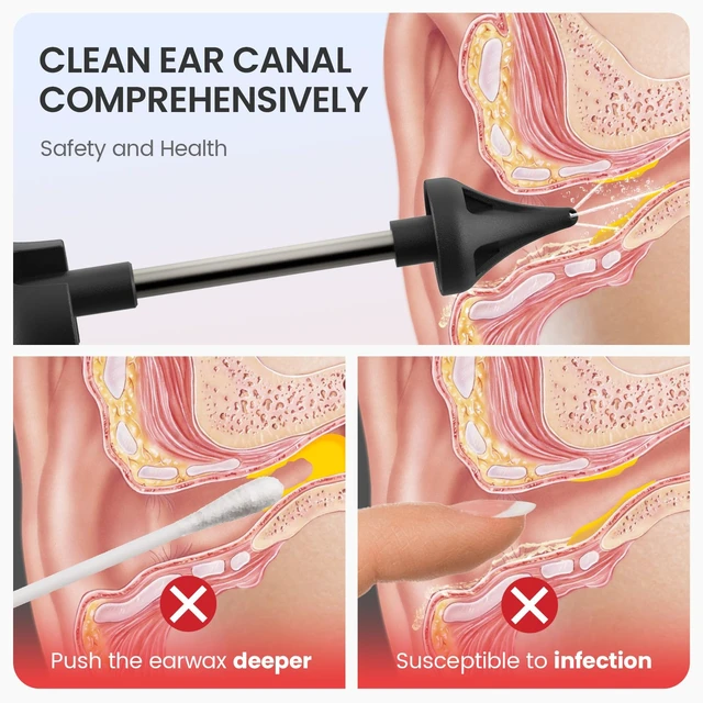 Alt view image 4 of 7 - Havenit Ear Wax Removal Kit, Ear Cleaner Earwax Removal, Ear Wax Removal Tool, Superior IPX5 Waterproof, 4 Safe and Sufficient Power Pressure Settings, 6 Pcs Ear Pick (Grey)