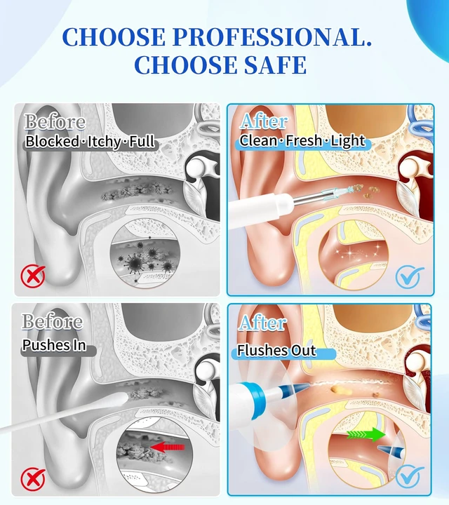 Alt view image 5 of 7 - Ear Wax Removal, Ear Cleaner with Camera 500ml Ear Cleaner Kit with HD Display & 4 Pressure Settings, Safe and Effective Ear Flush Kit with Ear Cleaner - Includes Basin, Towel & 16 Tips