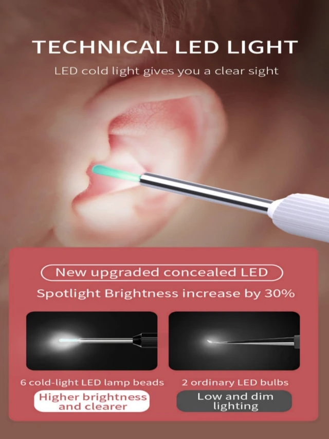 Alt view image 4 of 7 - Pro Ear Wax Removal, Ear Cleaner with 1080P HD Otoscope Camera and Light Plus 7Pcs Ear Set for All iPhone and Android Phones