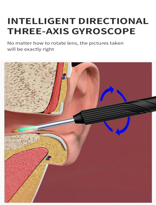 Alt view image 5 of 7 - Pro Ear Wax Removal, Ear Cleaner with 1080P HD Otoscope Camera and Light Plus 7Pcs Ear Set for All iPhone and Android Phones